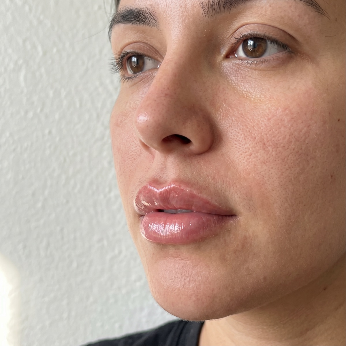 Resultado de Russian Lips con volumen definido y natural