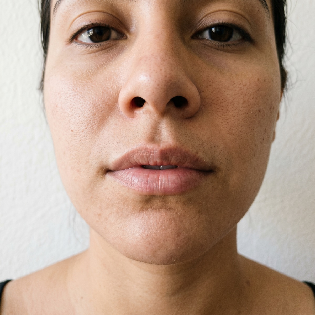 Labios antes de diseño Russian Lips en Puebla